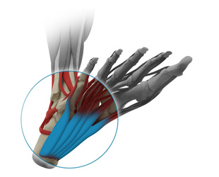 Relâchement du fascia plantaire