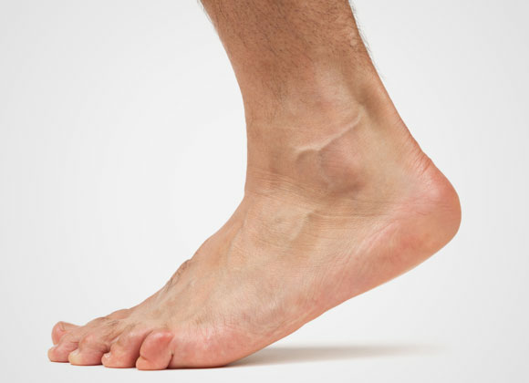 Ankle pain