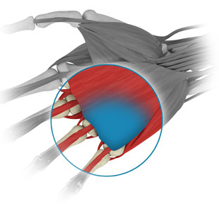 Palmar and digital fasciectomy